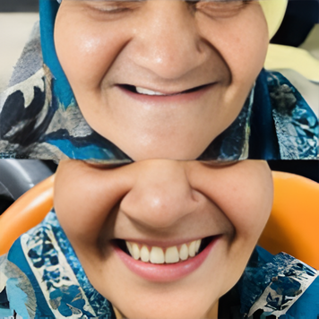 Denture Result 1